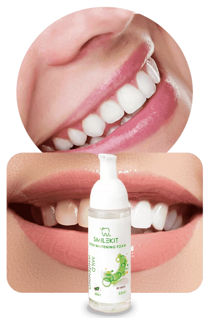 SMILEKIT - ESPUMA BLANQUEADORA